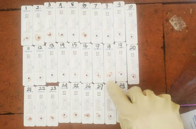 Usai Rapid Test Massal, Diskes Pekanbaru Temukan 10 Warga Reaktif